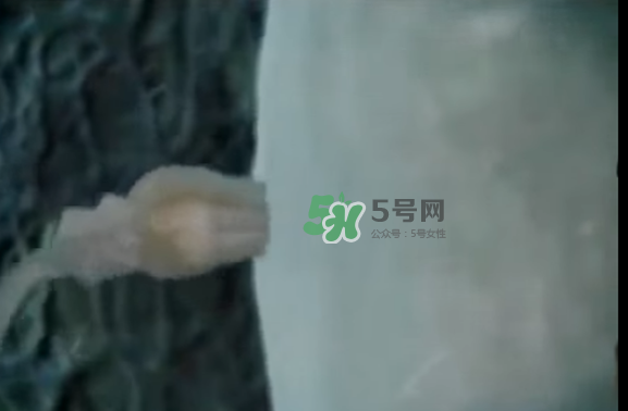 懷孕初期怎么保胎？陰道出血是流產(chǎn)征兆嗎？