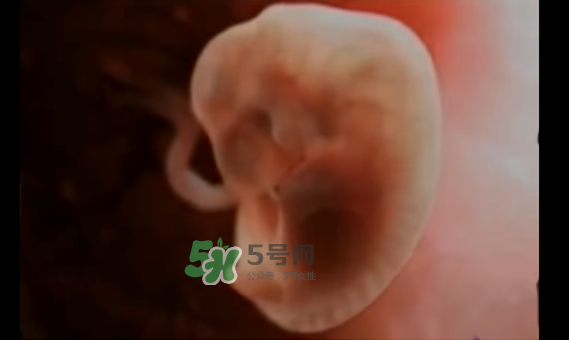 懷孕初期怎么保胎？陰道出血是流產(chǎn)征兆嗎？