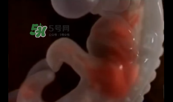 懷孕初期怎么保胎？陰道出血是流產(chǎn)征兆嗎？