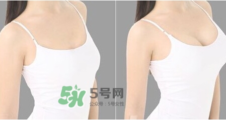 女性乳頭癢是怎么回事？女性乳頭癢要怎么治療？