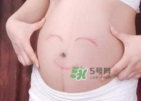 產婦胃脹氣怎么緩解？產婦胃脹氣怎么辦？