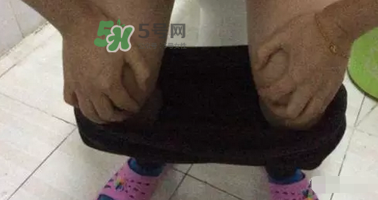 孕期可以蹲著上廁所嗎？孕期上廁所會壓到寶寶嗎？