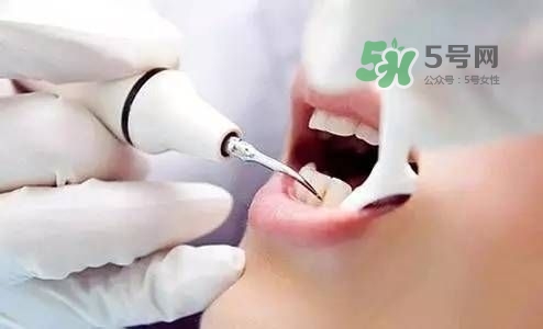孕婦能矯正牙齒嗎？懷孕期間可以矯正牙齒嗎？