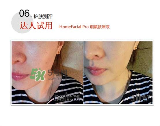 homefacialpro煙酰胺原液怎么樣？hfp煙酰胺原液好用嗎
