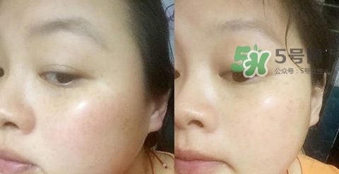 可思美潔面儀好不好用？可思美凈致潔顏聲波潔面儀怎么樣？
