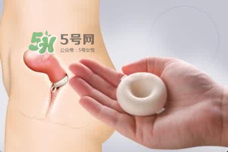 殺精劑有什么副作用？殺精劑的使用方法