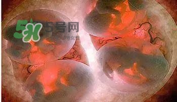 多胞胎是怎么生產(chǎn)的？多胞胎應選擇什么分娩方式