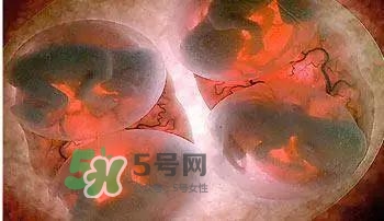多胞胎順產(chǎn)怎么生？多胞胎剖腹產(chǎn)和單胎剖腹產(chǎn)的區(qū)別