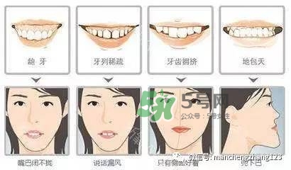 乳牙齲齒要不要補？乳牙齲齒怎么辦？