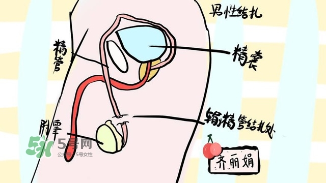 生完二胎一定要結(jié)扎嗎？生完二胎結(jié)扎好不好？