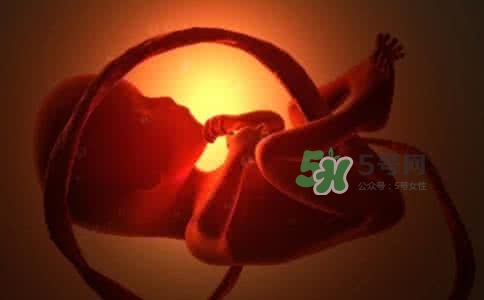 寶寶臍帶繞頸只能剖腹產(chǎn)嗎？胎兒臍帶繞頸孕婦有什么感覺