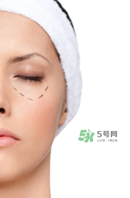 近視手術(shù)多少度不能做？多少度可以做近視手術(shù)？
