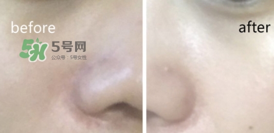 hr綠寶瓶新肌水怎么用？赫蓮娜綠寶瓶新肌水使用方法