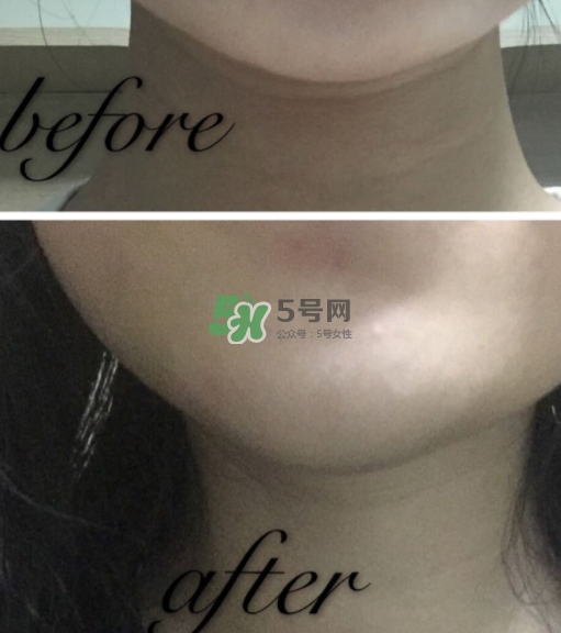 olay小白瓶有哪些版本？olay小白瓶版本區(qū)別
