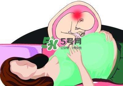孕婦左側(cè)臥睡不著怎么辦？孕期左側(cè)睡不舒服怎么辦？
