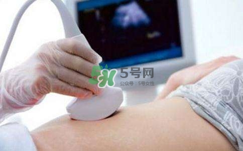 臍帶繞頸是什么原因造成的？臍帶繞頸是多休息還是多運(yùn)動？