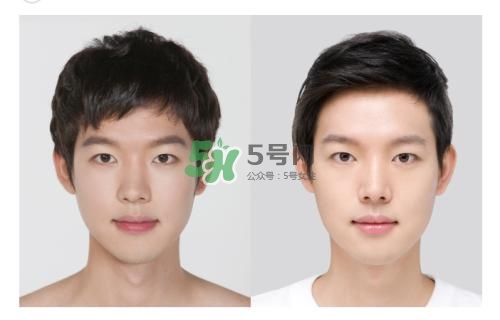 美白針有副作用嗎？美白針有什么副作用？