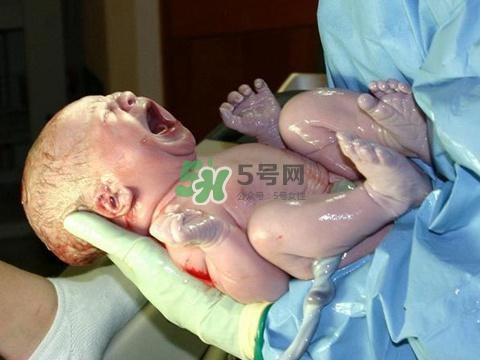 順產(chǎn)有多疼？順產(chǎn)的疼痛可以忍受嗎？