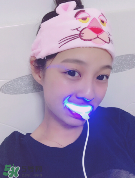 美牙儀能去牙結石嗎？美牙儀對牙結石有效嗎？