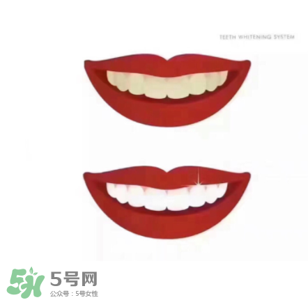 美牙儀能帶上飛機(jī)嗎？美牙儀可以過安檢嗎？
