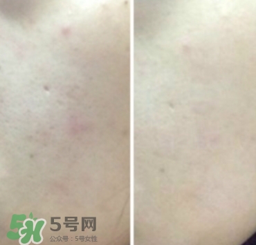 美康粉黛氣墊bb怎么樣？美康粉黛氣墊bb毀容