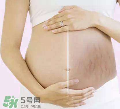 長妊娠紋的前兆 長妊娠紋很癢怎么辦？