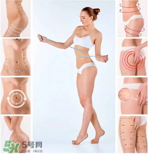 吸脂減肥會反彈嗎？吸脂減肥有沒有后遺癥？