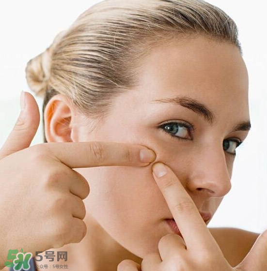 長(zhǎng)痘長(zhǎng)閉口怎么辦？長(zhǎng)痘長(zhǎng)閉口是什么原因？