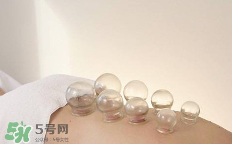 真空拔罐有用嗎？真空拔罐多長時間合適