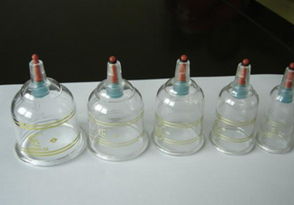 真空拔罐拔出水泡來是怎么回事？真空拔罐的正確使用方法