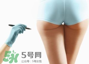 吸脂減肥副作用有哪些？吸脂減肥可靠嗎？