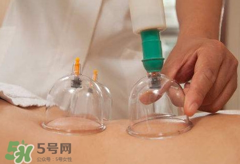 真空拔罐有用嗎？真空拔罐多長時間合適