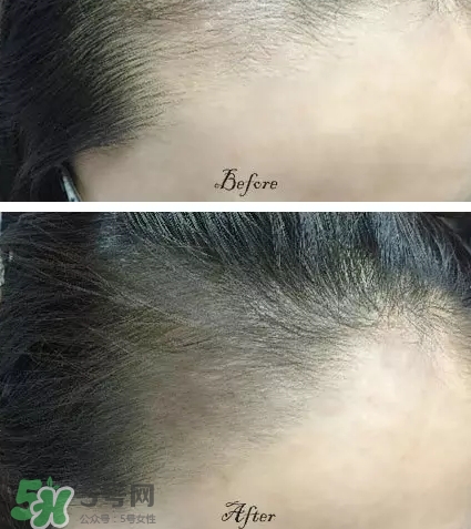 發(fā)際線粉要卸妝嗎_怎么卸？
