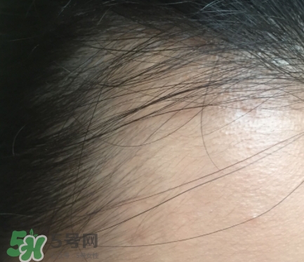 發(fā)際線粉要卸妝嗎_怎么卸？