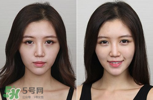 蘋果肌怎么化？蘋果肌究竟哪里好？