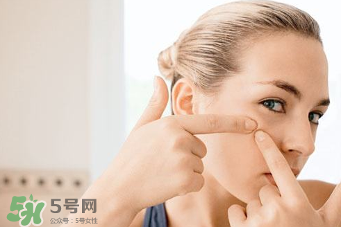 暗瘡可以擠壓嗎？油性和骯臟肌膚會(huì)容易有暗瘡嗎？