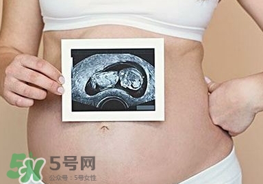 雙子宮可以上環(huán)嗎？雙子宮上環(huán)要注意哪些？