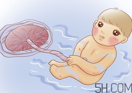 羊水過少能順產嗎？羊水過少的原因 