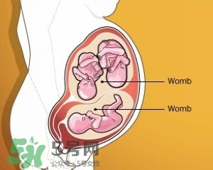 雙子宮是什么意思？雙子宮可以順產(chǎn)嗎？