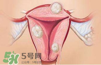 雙子宮可以上環(huán)嗎？雙子宮上環(huán)要注意哪些？