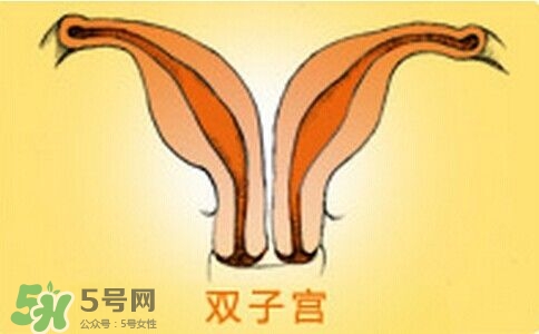 雙子宮是什么意思？雙子宮可以順產(chǎn)嗎？