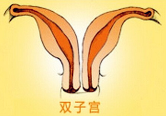 雙子宮是什么意思？雙子宮可以順產(chǎn)嗎？