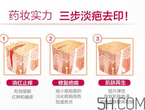 ISDIN怡思丁祛疤膏怎么用？ISDIN怡思丁祛疤膏使用說明