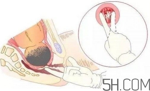 內(nèi)檢是什么感覺？?jī)?nèi)檢有男醫(yī)生嗎？