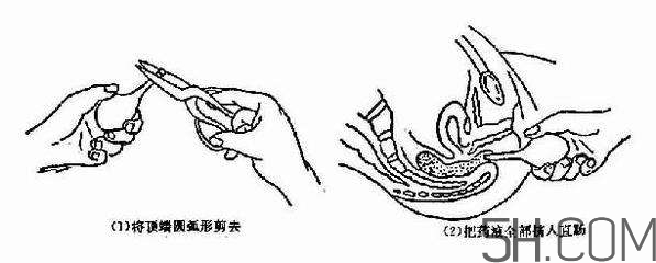 開(kāi)塞露怎么用？開(kāi)塞露用后多久會(huì)排便？