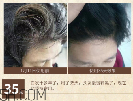 詩碧曼美發(fā)精華液價(jià)格 詩碧曼美發(fā)精華液評測