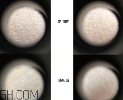恒久肌底循環(huán)精華露基礎型和加強型區(qū)別_怎么選