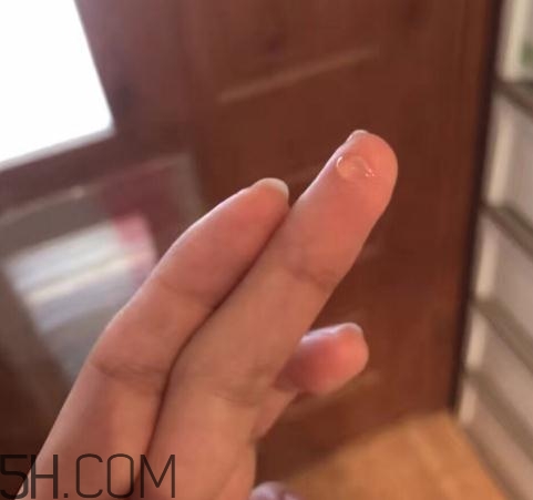 倍舒痕可以去痘印嗎？倍舒痕能涂在痘痘上嗎？