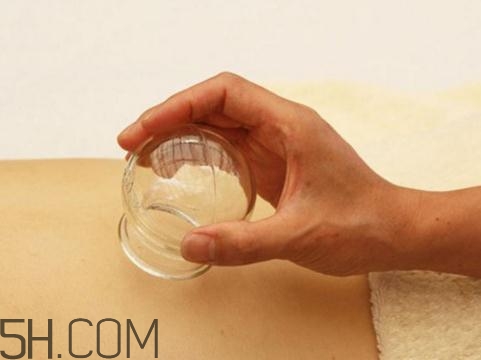 關節(jié)炎可以拔火罐嗎？關節(jié)炎拔罐管用嗎？