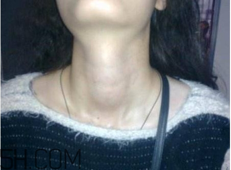 甲狀腺結節(jié)掛什么科？甲狀腺結節(jié)可以懷孕嗎